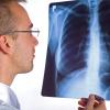 Radioloog kijkt naar röntgenopname van menselijke longen