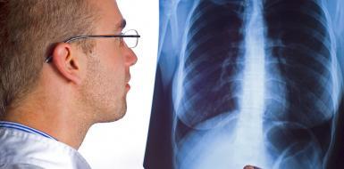 Een radioloog bekijkt een rontgenfoto van longen